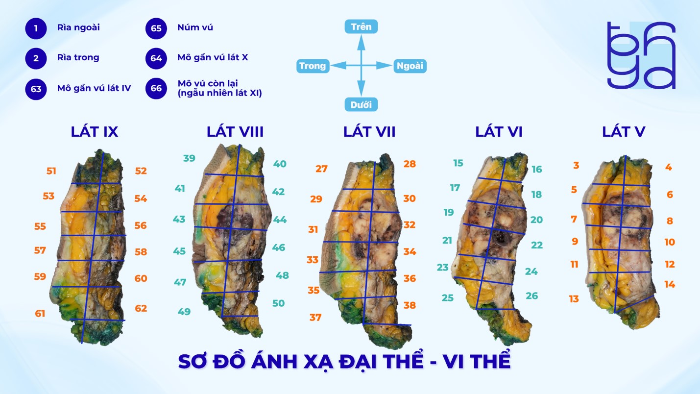 Hinh 3 - K. GPB.jpg
